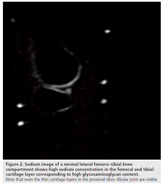 imaging-in-medicine-tibio–fibular