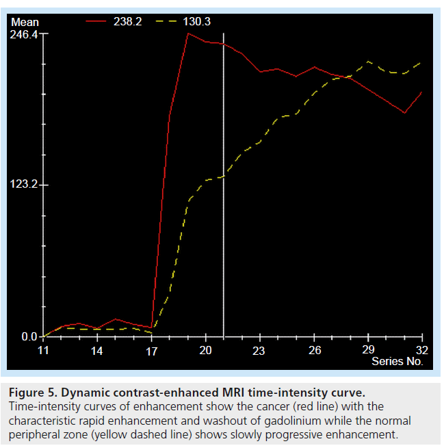 imaging-in-medicine-time-intensity