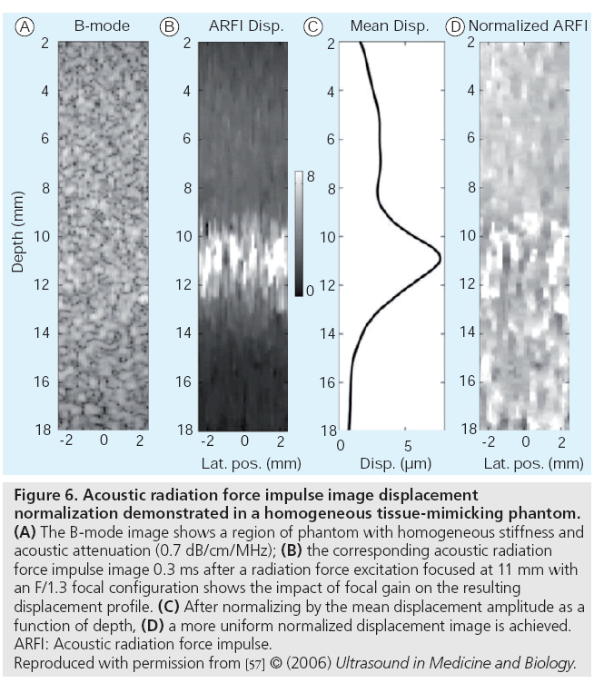 imaging-in-medicine-tissue-mimicking