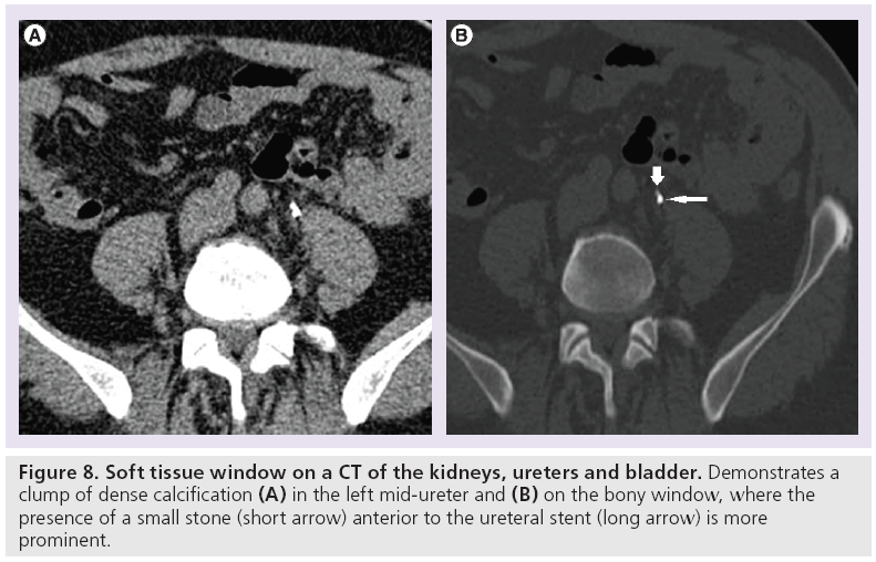 imaging-in-medicine-tissue-window