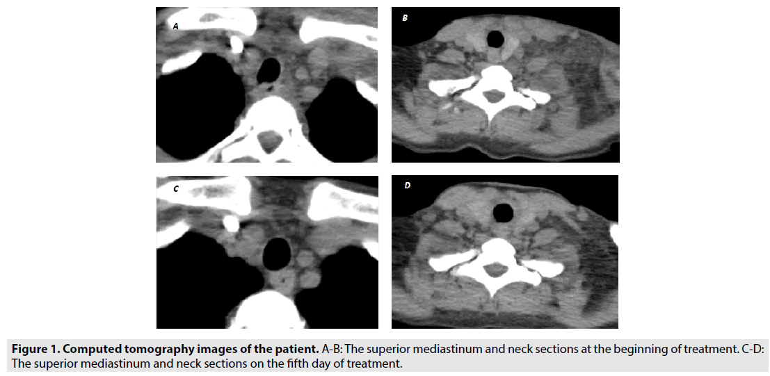 imaging-in-medicine-tomography-images