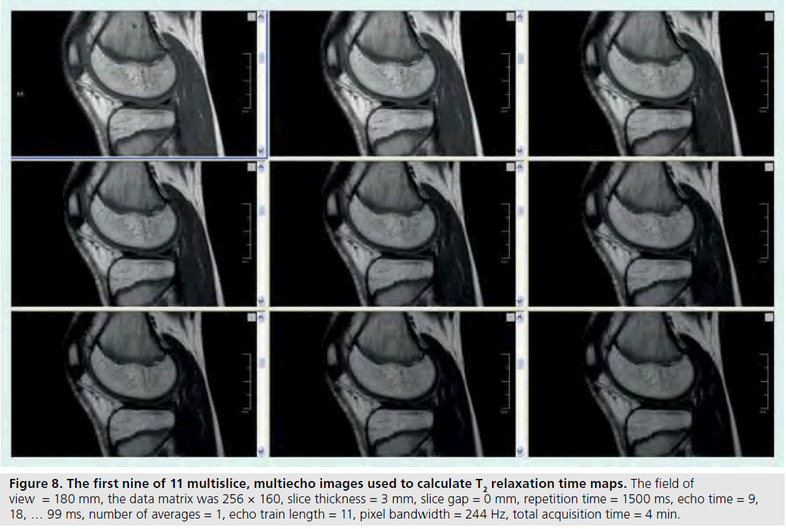 imaging-in-medicine-train-length