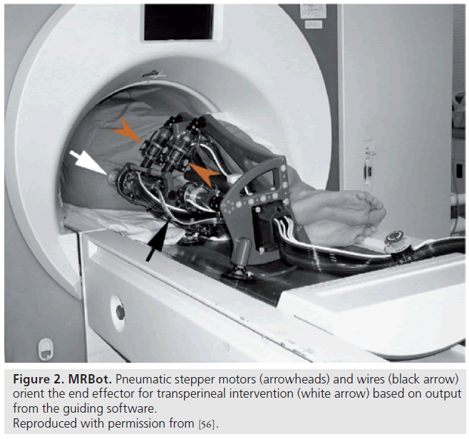 imaging-in-medicine-transperineal-intervention