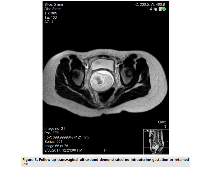 imaging-in-medicine-transvaginal