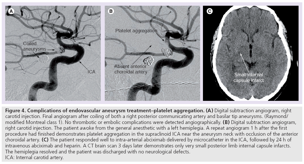 imaging-in-medicine-treatment–platelet