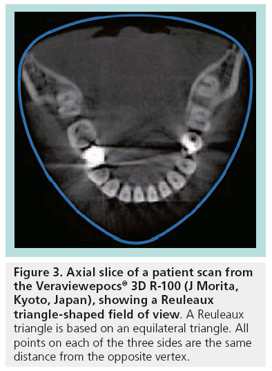 imaging-in-medicine-triangle-shaped