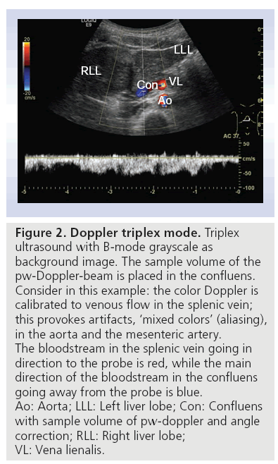 https://www.openaccessjournals.com/articles-images/imaging-in-medicine-triplex-mode-3-4-411-g002.png