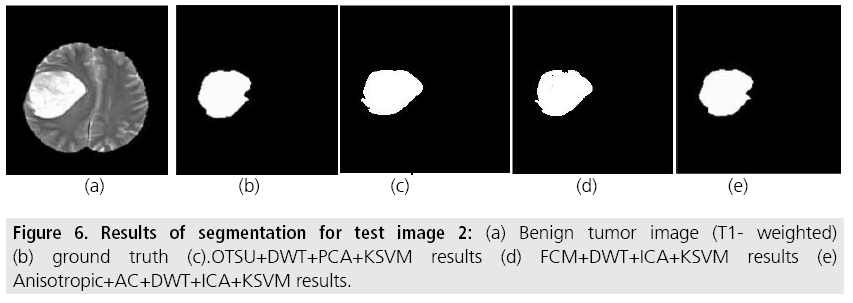 imaging-in-medicine-tumor-image