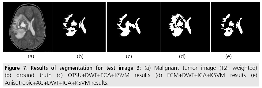 imaging-in-medicine-tumor-image