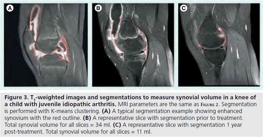 imaging-in-medicine-typical-segmentation