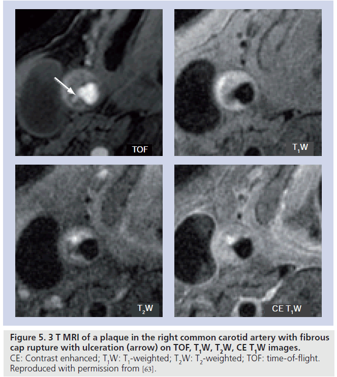 imaging-in-medicine-ulceration-arrow