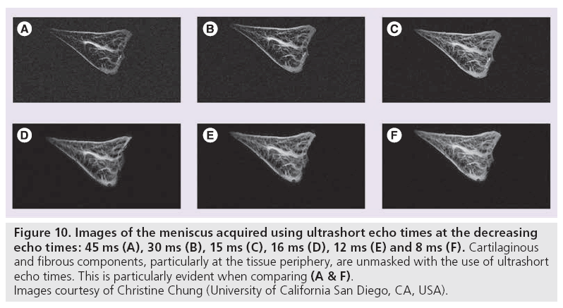 imaging-in-medicine-ultrashort-echo