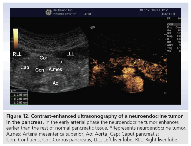 imaging-in-medicine-ultrasonography