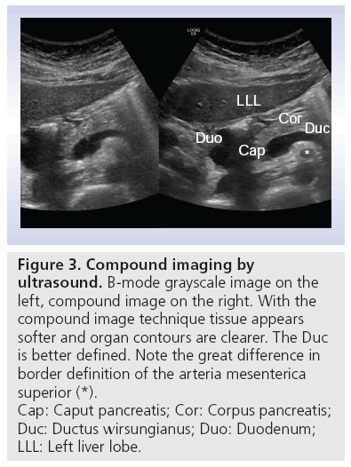 imaging-in-medicine-ultrasound