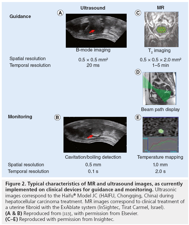 imaging-in-medicine-ultrasound-images