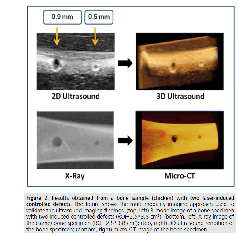 imaging-in-medicine-ultrasound-rendition