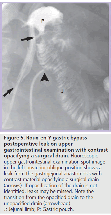 imaging-in-medicine-upper-gastrointestinal