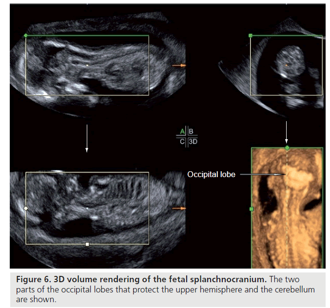 imaging-in-medicine-upper-hemisphere