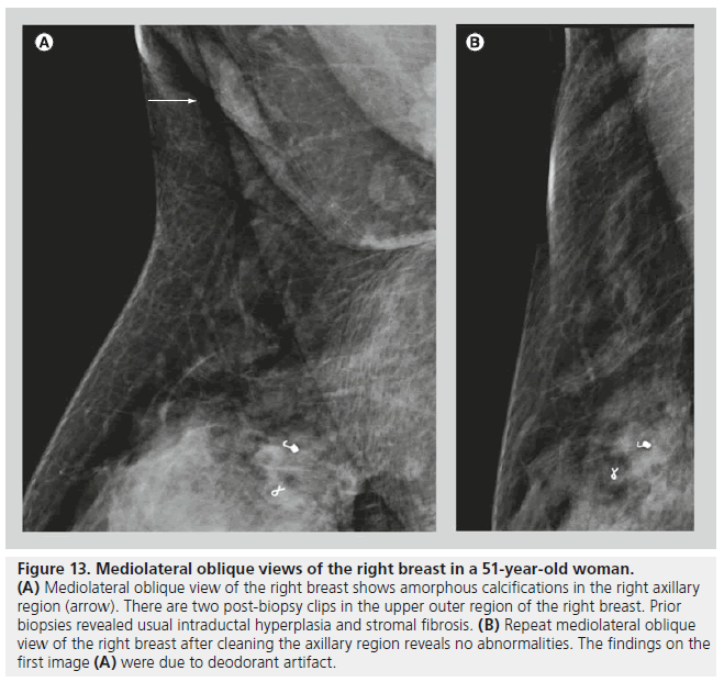 imaging-in-medicine-upper-outer