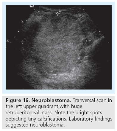 imaging-in-medicine-upper-quadrant