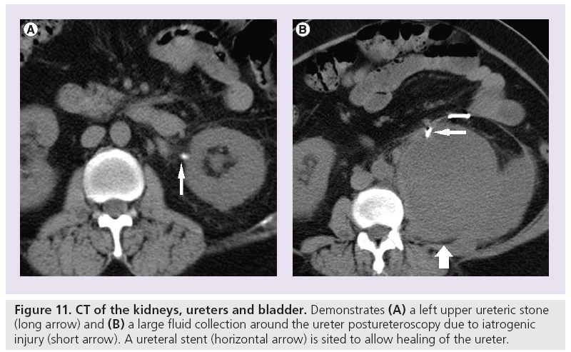 imaging-in-medicine-ureters-bladder