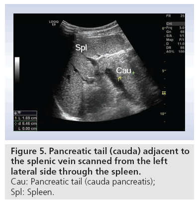 imaging-in-medicine-vein-scanned