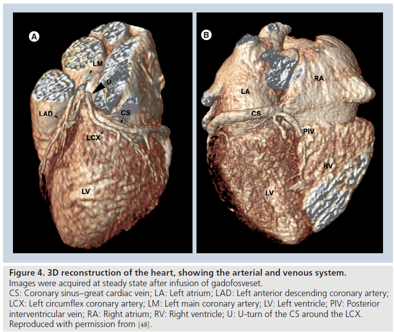 imaging-in-medicine-venous-system