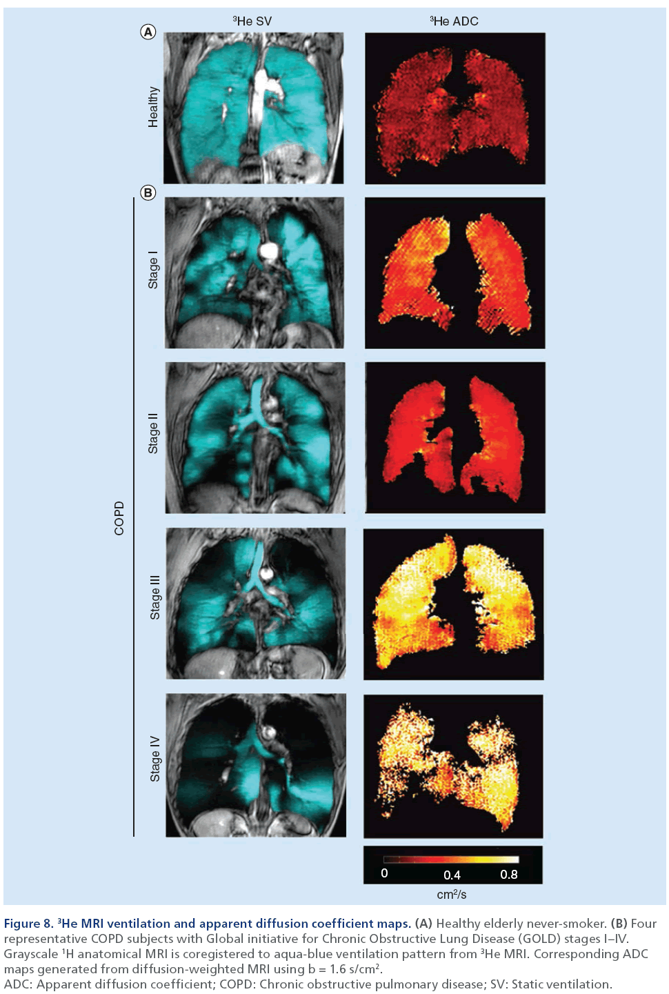 imaging-in-medicine-ventilation-apparent