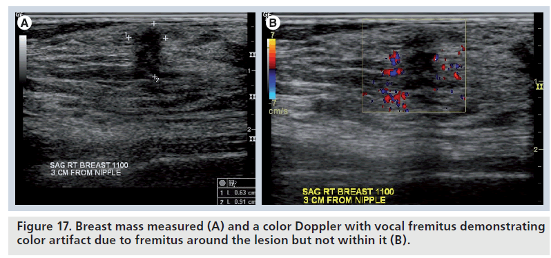 imaging-in-medicine-vocal-fremitus