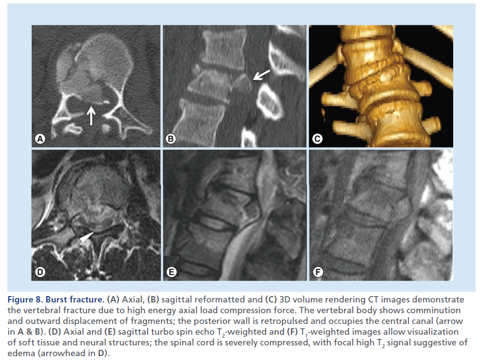 imaging-in-medicine-volume-rendering