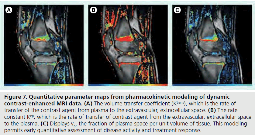 imaging-in-medicine-volume-transfer