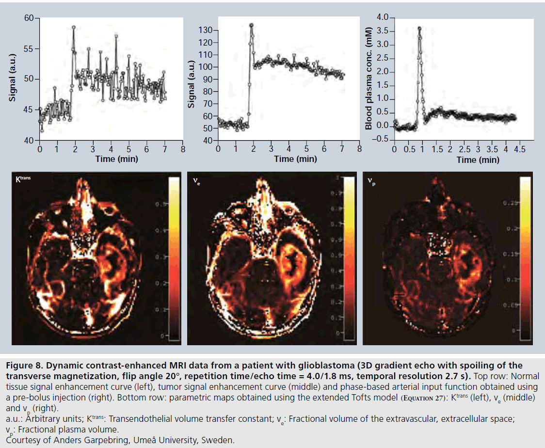 imaging-in-medicine-volume-transfer