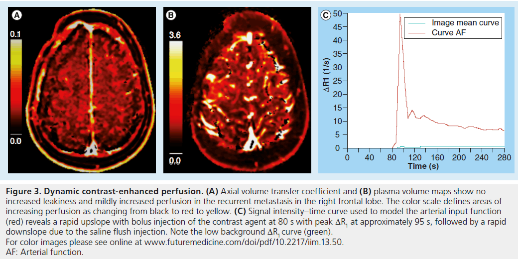 imaging-in-medicine-volume-transfer