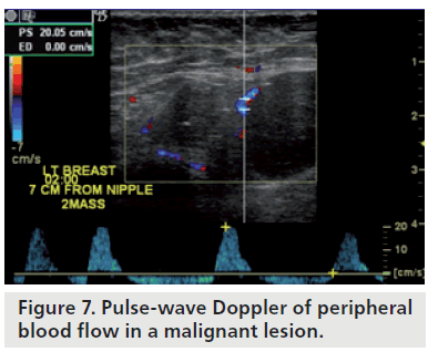 imaging-in-medicine-wave-Doppler