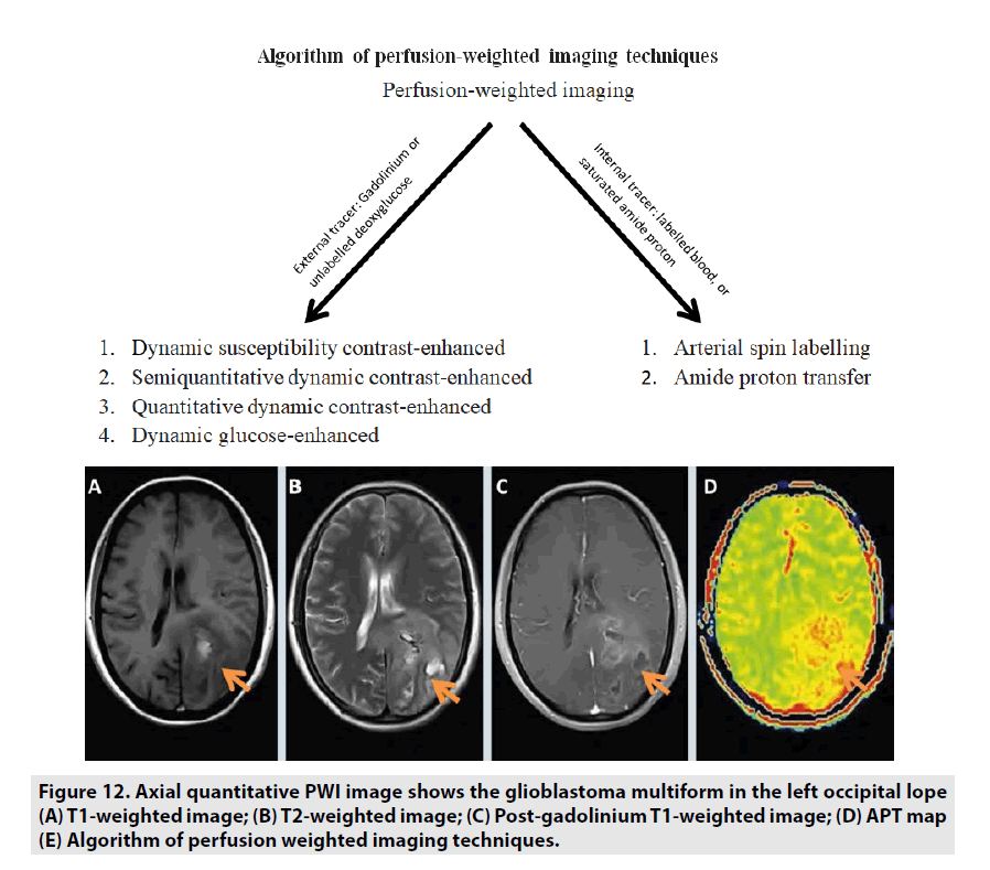 imaging-in-medicine-weighted-image