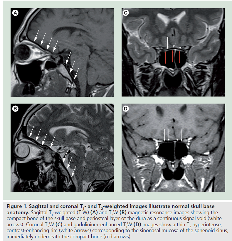 imaging-in-medicine-weighted-images