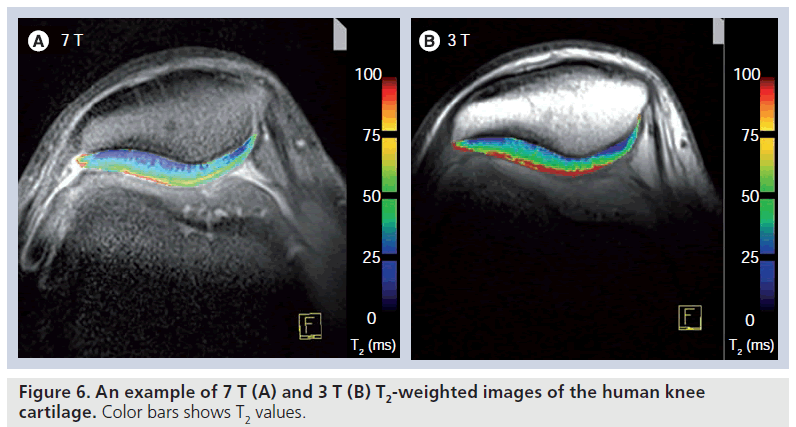 imaging-in-medicine-weighted–images