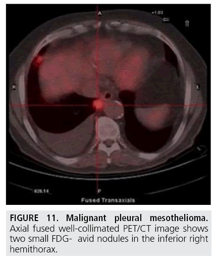 imaging-in-medicine-well-collimated