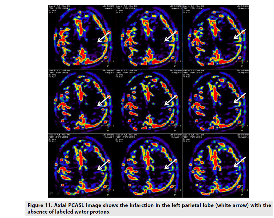 imaging-in-medicine-white-arrow