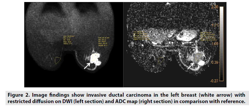 imaging-in-medicine-white-arrow