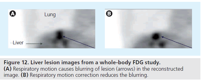 imaging-in-medicine-whole-body