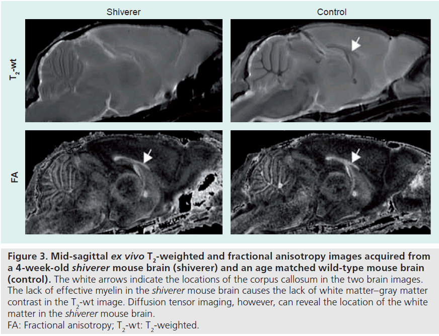 imaging-in-medicine-wild-type