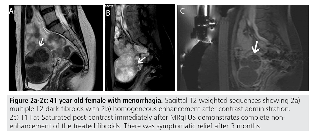 imaging-medicine-Sagittal-t2-weighted-sequences