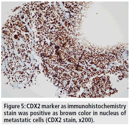 imaging-medicine-cdx2-marker-immunohistochemistry