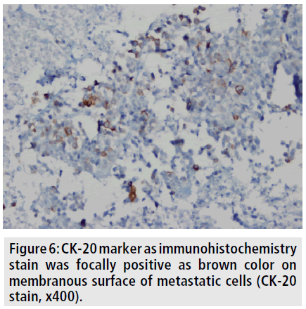 imaging-medicine-ck-20-marker-immunohistochemistry