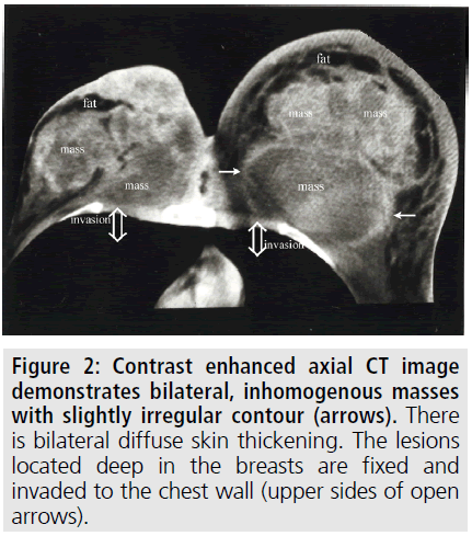 imaging-medicine-contrast-enhanced-axial
