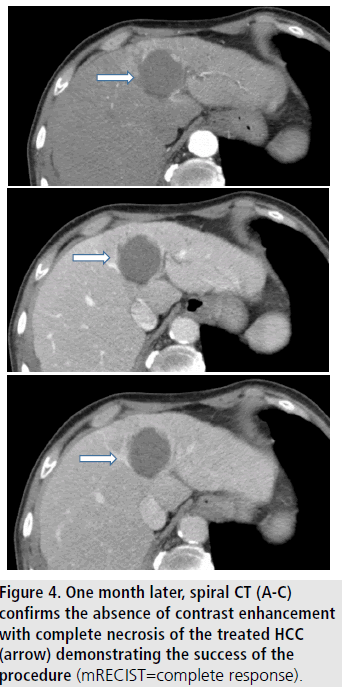 imaging-medicine-contrast-enhancement