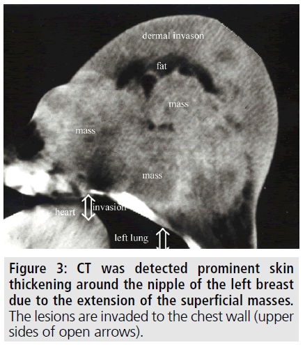 imaging-medicine-ct-detected-prominent-skin