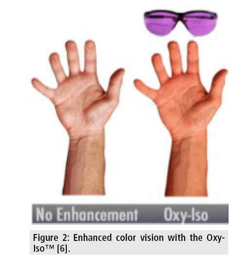 imaging-medicine-enhanced-color-vision