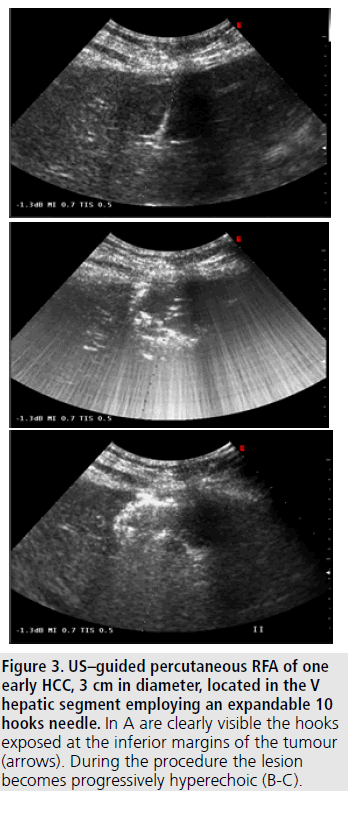 imaging-medicine-guided-percutaneous
